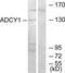 Adenylate Cyclase 1 antibody, TA311696, Origene, Western Blot image 