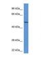 Acid Phosphatase 2, Lysosomal antibody, NBP1-74241, Novus Biologicals, Western Blot image 