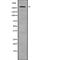 Acetyl-CoA Carboxylase Beta antibody, abx147901, Abbexa, Western Blot image 