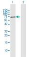 Poly(ADP-Ribose) Polymerase Family Member 3 antibody, H00010039-B01P, Novus Biologicals, Western Blot image 