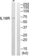 Interleukin 18 Receptor 1 antibody, abx015092, Abbexa, Western Blot image 