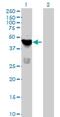 Testis Specific Serine Kinase 1B antibody, H00083942-B01P, Novus Biologicals, Western Blot image 