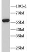 6-phosphofructo-2-kinase/fructose-2,6-biphosphatase 2 antibody, FNab06338, FineTest, Western Blot image 