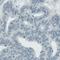 Asparaginase Like 1 antibody, NBP2-42378, Novus Biologicals, Immunohistochemistry paraffin image 