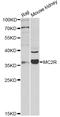 Melanocortin 2 Receptor antibody, STJ24517, St John