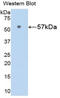Nicotinamide Phosphoribosyltransferase antibody, MBS2005393, MyBioSource, Western Blot image 