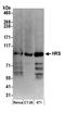 Hepatocyte Growth Factor-Regulated Tyrosine Kinase Substrate antibody, A300-989A, Bethyl Labs, Western Blot image 
