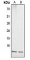 Cytochrome c oxidase copper chaperone antibody, LS-C353218, Lifespan Biosciences, Western Blot image 