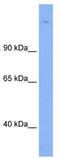 SIN3 Transcription Regulator Family Member B antibody, TA341814, Origene, Western Blot image 