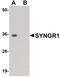 Synaptogyrin 1 antibody, PA5-20876, Invitrogen Antibodies, Western Blot image 