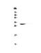 Major Histocompatibility Complex, Class II, DQ Beta 1 antibody, PA5-79370, Invitrogen Antibodies, Western Blot image 