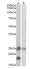 Dynactin Subunit 3 antibody, orb125073, Biorbyt, Western Blot image 