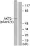 AKT Serine/Threonine Kinase 2 antibody, LS-C117288, Lifespan Biosciences, Western Blot image 