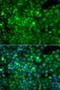 Calpain 5 antibody, orb247959, Biorbyt, Immunofluorescence image 