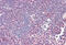 Zeta Chain Of T Cell Receptor Associated Protein Kinase 70 antibody, MBS245383, MyBioSource, Immunohistochemistry frozen image 