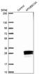 Apolipoprotein B MRNA Editing Enzyme Catalytic Subunit 3A antibody, PA5-60288, Invitrogen Antibodies, Western Blot image 