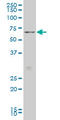 Forkhead Box O1 antibody, LS-C104950, Lifespan Biosciences, Western Blot image 