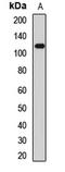 Transient Receptor Potential Cation Channel Subfamily A Member 1 antibody, LS-C668654, Lifespan Biosciences, Western Blot image 