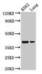Pentraxin-related protein PTX3 antibody, CSB-PA019079LA01HU, Cusabio, Western Blot image 