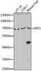 Interferon Induced Protein With Tetratricopeptide Repeats 3 antibody, LS-C749018, Lifespan Biosciences, Western Blot image 
