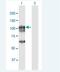 Cancer/Testis Antigen 1B antibody, H00285782-B01P-50ug, Novus Biologicals, Western Blot image 