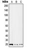 Interleukin 2 antibody, LS-C353777, Lifespan Biosciences, Western Blot image 