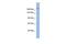 Bromodomain Adjacent To Zinc Finger Domain 1A antibody, GTX44612, GeneTex, Western Blot image 