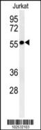 Serine/Threonine Kinase 33 antibody, 63-139, ProSci, Western Blot image 