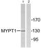 Protein Phosphatase 1 Regulatory Subunit 12A antibody, PA5-38300, Invitrogen Antibodies, Western Blot image 