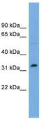 PHD Finger Protein 13 antibody, TA339151, Origene, Western Blot image 