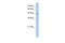 Patatin Like Phospholipase Domain Containing 5 antibody, A12975, Boster Biological Technology, Western Blot image 