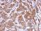 Murine Retrovirus Integration Site 1 Homolog antibody, NBP2-16987, Novus Biologicals, Immunohistochemistry paraffin image 
