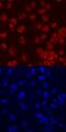 Forkhead Box C2 antibody, MAB5044, R&D Systems, Immunocytochemistry image 