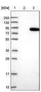 Glycerophosphocholine Phosphodiesterase 1 antibody, PA5-58835, Invitrogen Antibodies, Western Blot image 