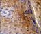 Keratin 10 antibody, PA5-13663, Invitrogen Antibodies, Immunohistochemistry paraffin image 