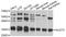 Nudix Hydrolase 5 antibody, STJ112517, St John