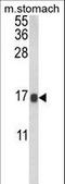 Galectin 2 antibody, LS-C165746, Lifespan Biosciences, Western Blot image 