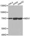 Menin 1 antibody, abx001844, Abbexa, Western Blot image 