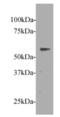 Frizzled Class Receptor 5 antibody, MBS857178, MyBioSource, Western Blot image 