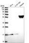 Zinc Finger Protein 317 antibody, HPA048625, Atlas Antibodies, Western Blot image 