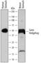 Sonic Hedgehog Signaling Molecule antibody, AF445, R&D Systems, Western Blot image 