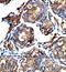 Ankyrin Repeat Domain 45 antibody, orb78100, Biorbyt, Immunohistochemistry paraffin image 