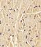 Procollagen-Lysine,2-Oxoglutarate 5-Dioxygenase 1 antibody, 56-571, ProSci, Immunohistochemistry frozen image 