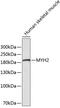 Myosin Heavy Chain 2 antibody, 19-106, ProSci, Western Blot image 