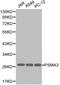 Proteasome Subunit Alpha 3 antibody, LS-C192507, Lifespan Biosciences, Western Blot image 