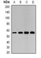 Leucine Aminopeptidase 3 antibody, LS-B16064, Lifespan Biosciences, Western Blot image 