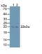 Proteasome Subunit Beta 8 antibody, LS-C295094, Lifespan Biosciences, Western Blot image 