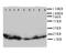 Cytoglobin antibody, LS-C312809, Lifespan Biosciences, Western Blot image 