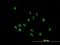 Immunoglobulin Heavy Constant Alpha 2 (A2m Marker) antibody, H00003494-B01P, Novus Biologicals, Immunocytochemistry image 