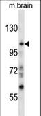 PEAK1 Related, Kinase-Activating Pseudokinase 1 antibody, LS-C164575, Lifespan Biosciences, Western Blot image 